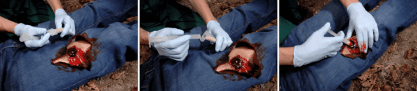 Celox-A Applicator