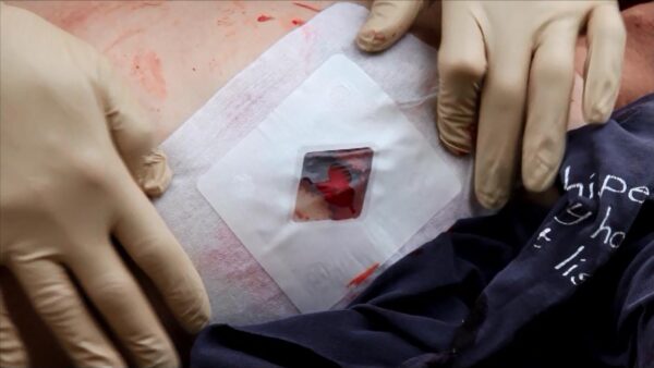 Safeguard Medical Russell Chest Seal