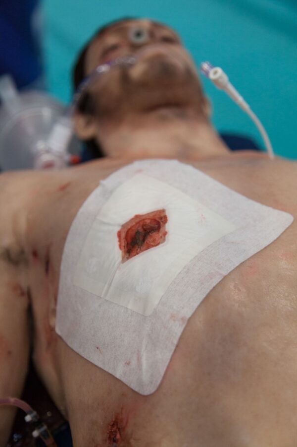 Safeguard Medical Russell Chest Seal